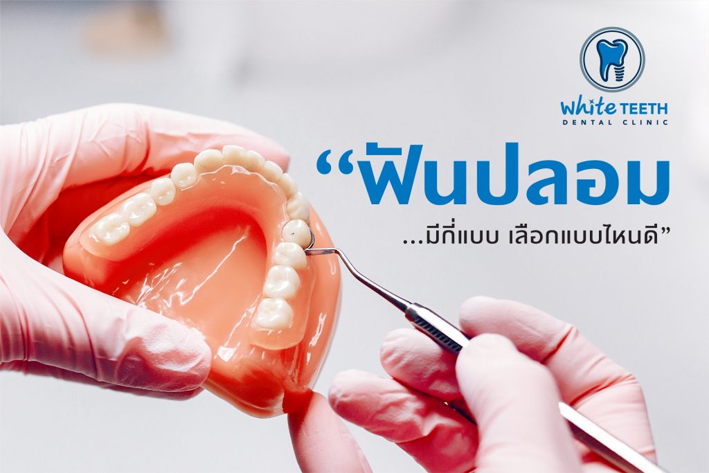ฟันปลอม (Denture) - คลินิกทันตกรรมไวท์ทีธ (White Teeth Dental Clinic)