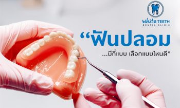 ฟันปลอม (Denture) - คลินิกทันตกรรมไวท์ทีธ (White Teeth Dental Clinic)