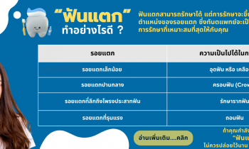 ฟันแตก ทำอย่างไรดี รักษาได้ไหม